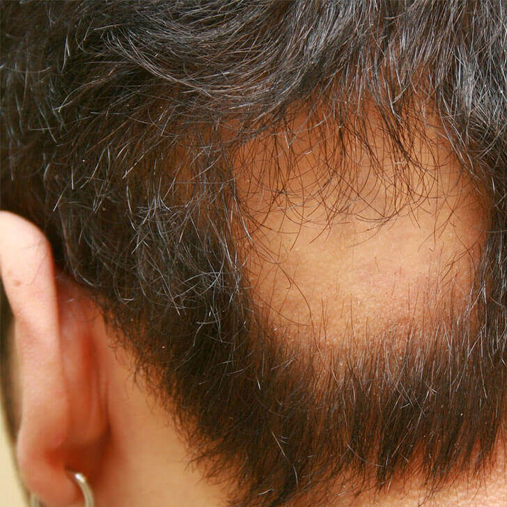 farmacia manipulacao campinas nova natural blog natureza magistral cabelo queda cabelo principais causas doencas autoimunes
