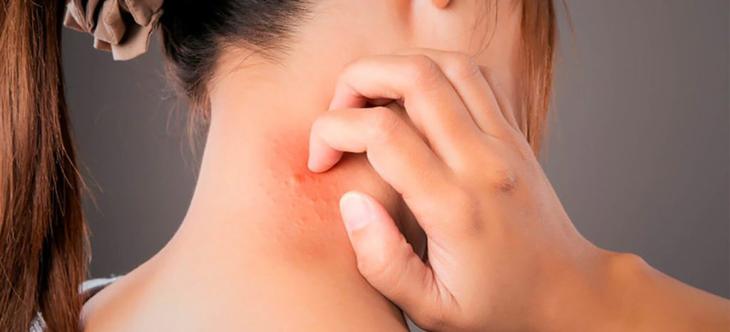 farmacia manipulacao campinas nova natural blog natureza magistal pele alergias pele comuns tratamentos
