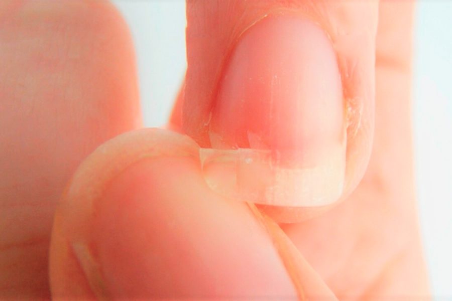 farmacia manipulacao campinas nova natural blog causas e tratamentos para unhas fracas e quebradicas